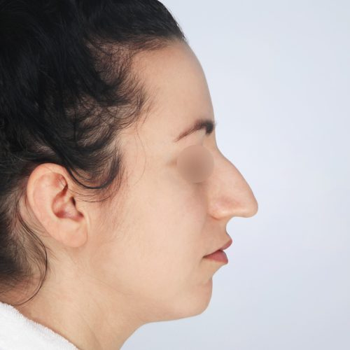 Kulicki8A-59365-aspect-ratio-500-500