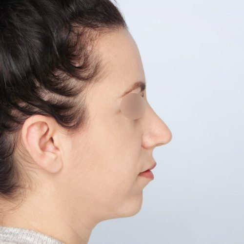 Kulicki8B-59365-aspect-ratio-500-500