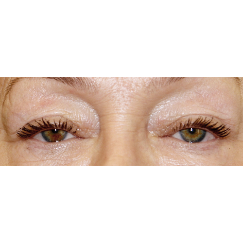 Michal1A-1-aspect-ratio-500-500