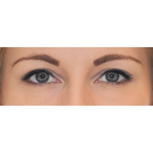 Michal1B-1-aspect-ratio-500-500