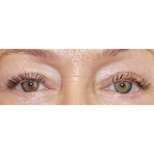 Michal1B-2-aspect-ratio-500-500