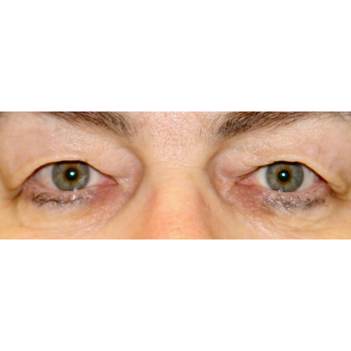 Michal2A-1-aspect-ratio-500-500