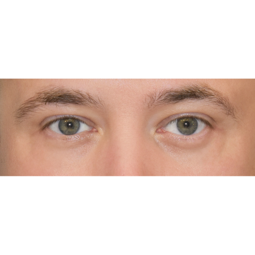 Michal2B-1-aspect-ratio-500-500