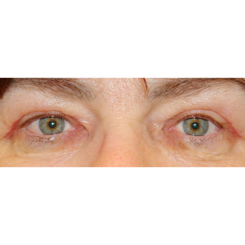 Michal2B-2-aspect-ratio-500-500