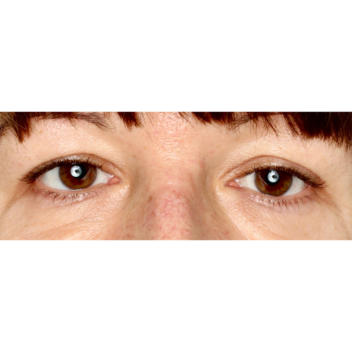 Michal5A-1-aspect-ratio-500-500