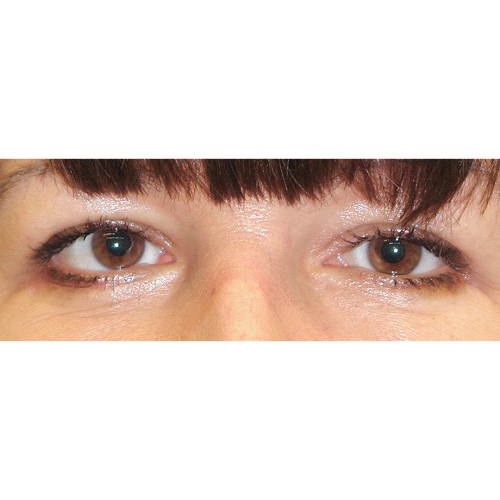 Michal5B-1-aspect-ratio-500-500