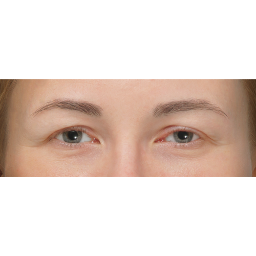 Michal7A-aspect-ratio-500-500