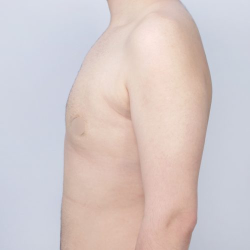 Bieganski1B-59661-aspect-ratio-500-500