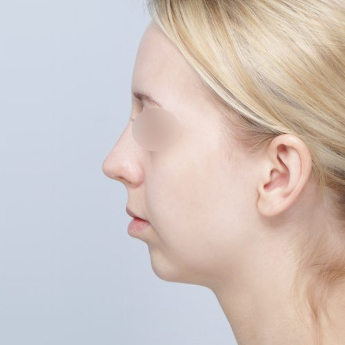 Kulicki1A-56502-aspect-ratio-500-500