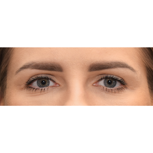 Michal5A-Copy-aspect-ratio-500-500