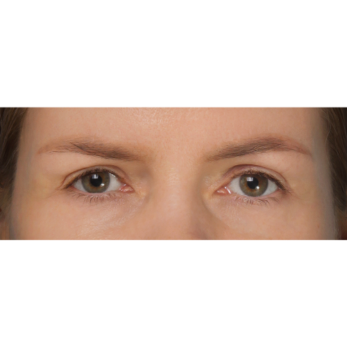 Michal6A-Copy-aspect-ratio-500-500