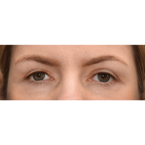 Michal6B-Copy-aspect-ratio-500-500