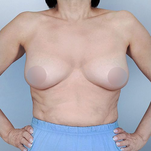 Donocik-1A-aspect-ratio-500-500