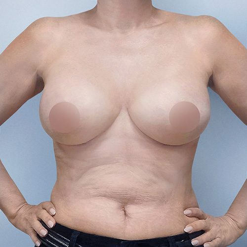 Donocik-1B-aspect-ratio-500-500