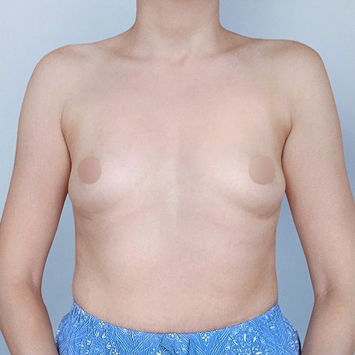 Donocik-3A-aspect-ratio-500-500