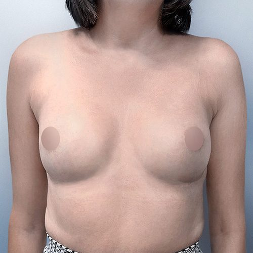 Donocik-3B-aspect-ratio-500-500