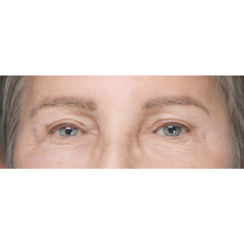 miszczyk-lift-pow-d-1A-aspect-ratio-500-500