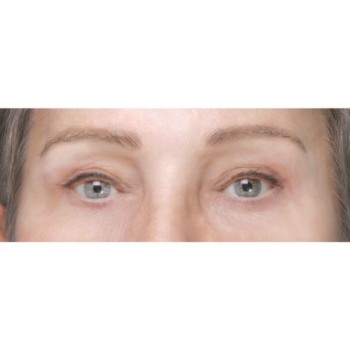 miszczyk-lift-pow-d-1B-aspect-ratio-500-500