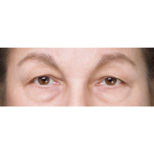 miszczyk-powieki-g-d-1A-aspect-ratio-500-500