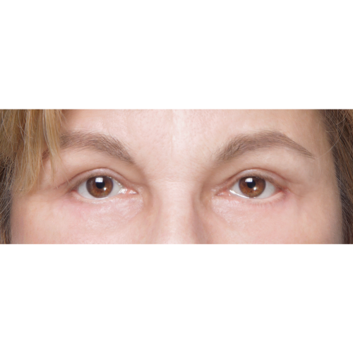 miszczyk-powieki-g-d-1B-aspect-ratio-500-500