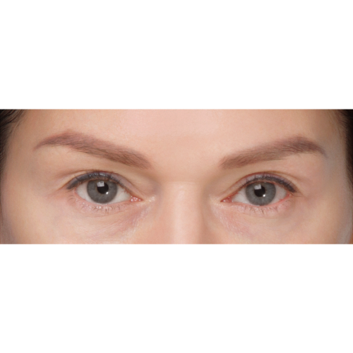 michal-powieki-gorne-id59681-8a-aspect-ratio-500-500