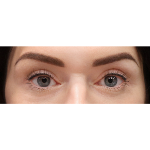 michal-powieki-gorne-id59681-8b-aspect-ratio-500-500