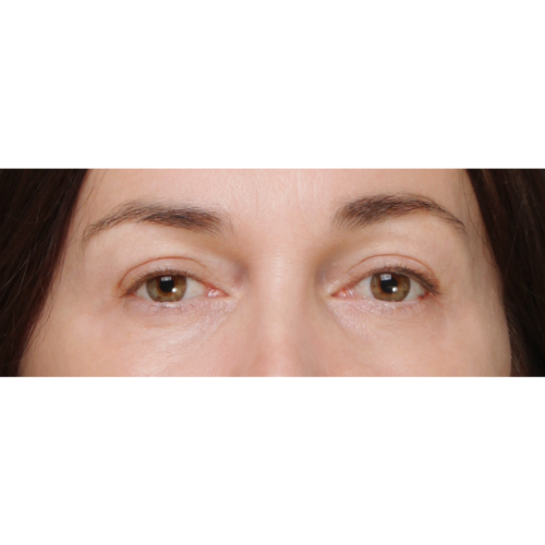 michal-powieki-lift-id58042-9a-aspect-ratio-500-500