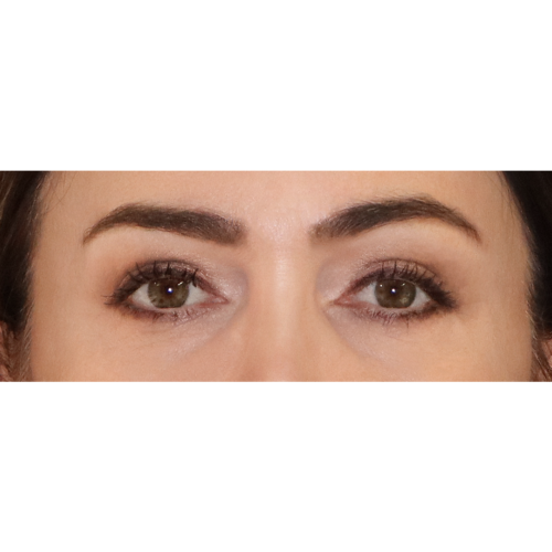 michal-powieki-lift-id58042-9b-aspect-ratio-500-500