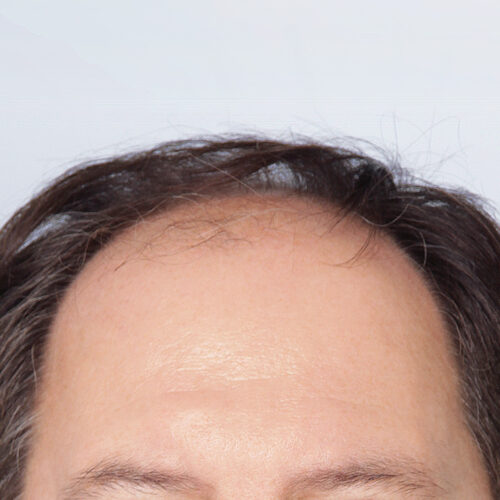 32a-59422-aspect-ratio-500-500