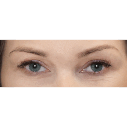 michal1a-2-aspect-ratio-500-500