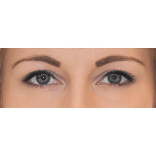 michal1b-aspect-ratio-500-500