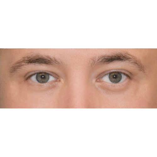 michal2b-1-aspect-ratio-500-500