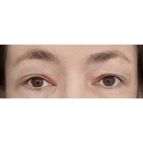 miszczyk1b-3-aspect-ratio-500-500