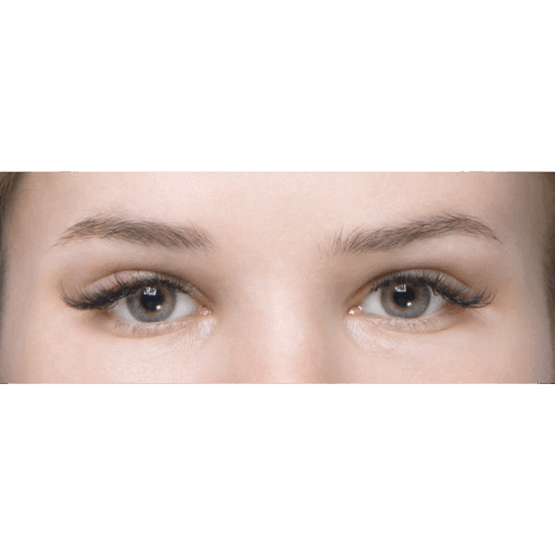 miszczyk-endo-brwi-id70212-19b-aspect-ratio-500-500