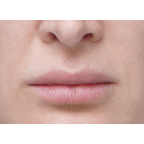 miszczyk-liplift-id71201-3a-aspect-ratio-500-500