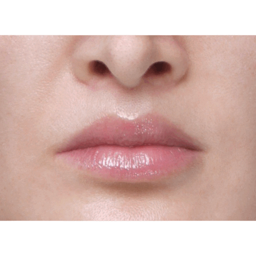 miszczyk-liplift-id71201-3b-aspect-ratio-500-500