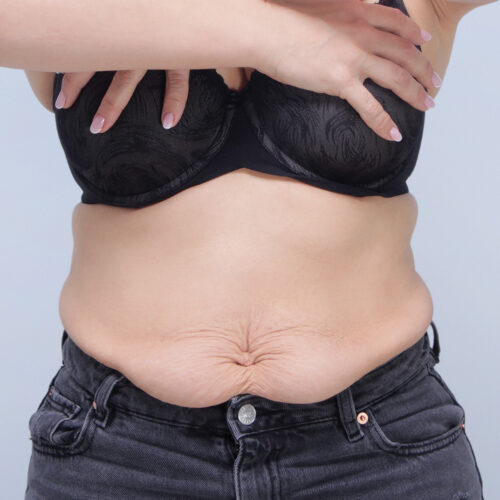 ferenc-id68073-brzuch-8a-aspect-ratio-500-500