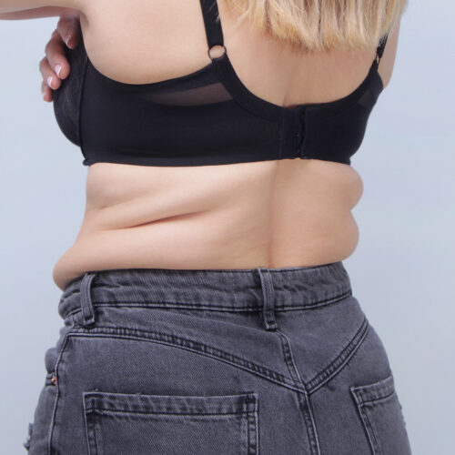 ferenc-id68073-brzuch-8e-aspect-ratio-500-500