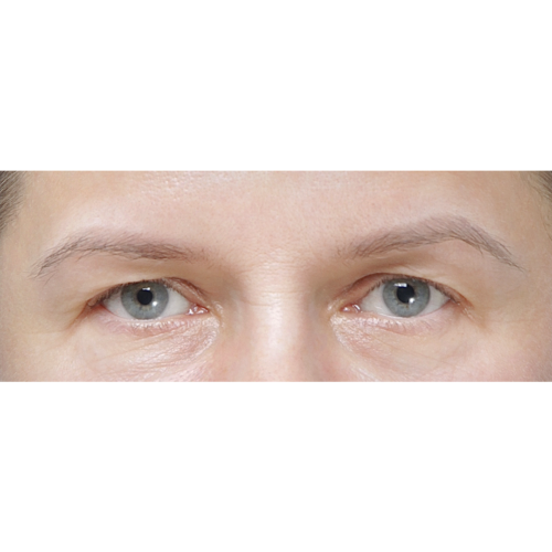 miszczyk-endo-brwi-id71526-20a-aspect-ratio-500-500