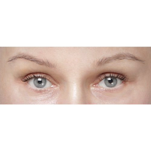 miszczyk-endo-brwi-id71526-20b-aspect-ratio-500-500